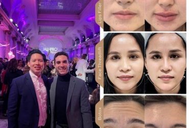 Face Contouring